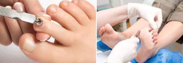 Bev Ramscar Footcare - image bev-1 on https://onlineweddingdirectory.co.uk